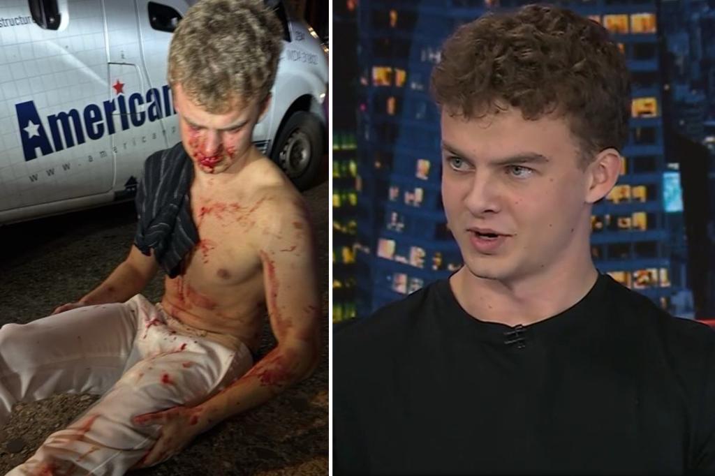 🚨 BREAKING: Two teens who brutally attacked ex-DOGE staffer Edward “Big Balls” Coristine in a D.C. parking garage have avoided jail — sentenced only to probation.

Coristine suffered a concussion and a broken nose in the assault.