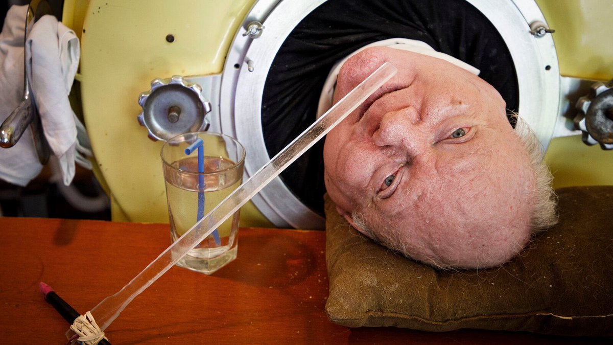 <a href="/historyinmemes/">Historic Vids</a> Paul Richard Alexander was six years old in 1952 when he contracted polio during one of the worst outbreaks in U.S. history. 

The disease left him completely paralyzed from the neck down and unable to breathe on his own, forcing him to live inside an iron lung — a massive metal