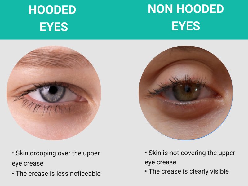 レゼは一重なんじゃなくて海外で言うとこのnon-hooded eyes だと思ってる。
日本人に多い二重じゃなくて眼窩が深いやつ