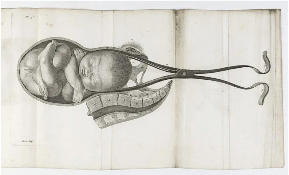 📣 Seminar Tonight!

Join Professor Lynne Vallone and a team from Queen Mary’s Women’s Health Research Unit for tonight’s seminar “The Foetus and Birthing Tools Across Disciplines” for tonight’s seminar at Queen Mary University of London 👶