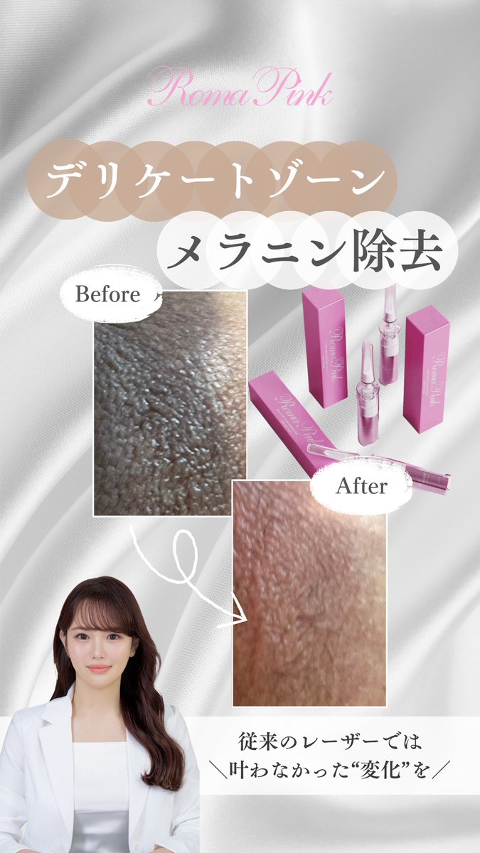 ビーナスピンク　メラニンケア ビーナスピンク メラニンケア 新発想のメラニンケア化粧品「DOLL PINK