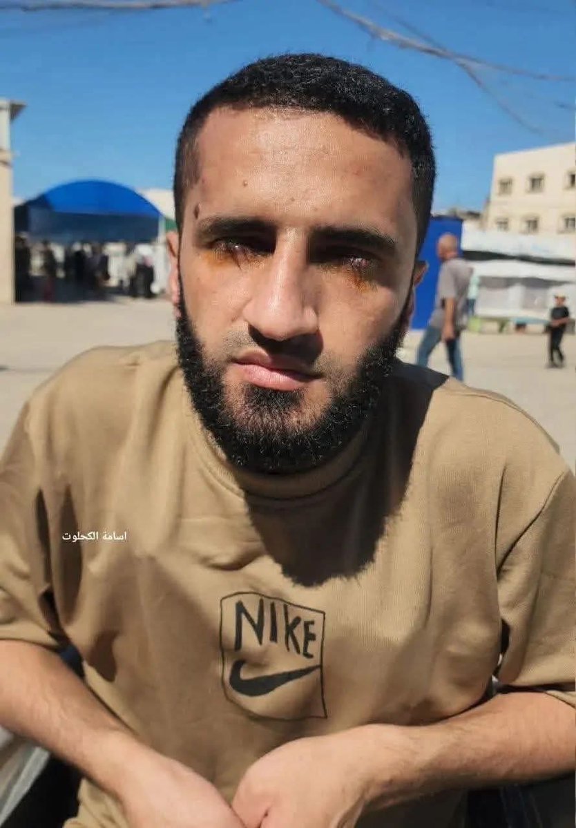 الاسير محمود ابو الفول من غزة خرج من سجون الاحتلال فاقد لعينيه من شده التعذيب مبتور القدم