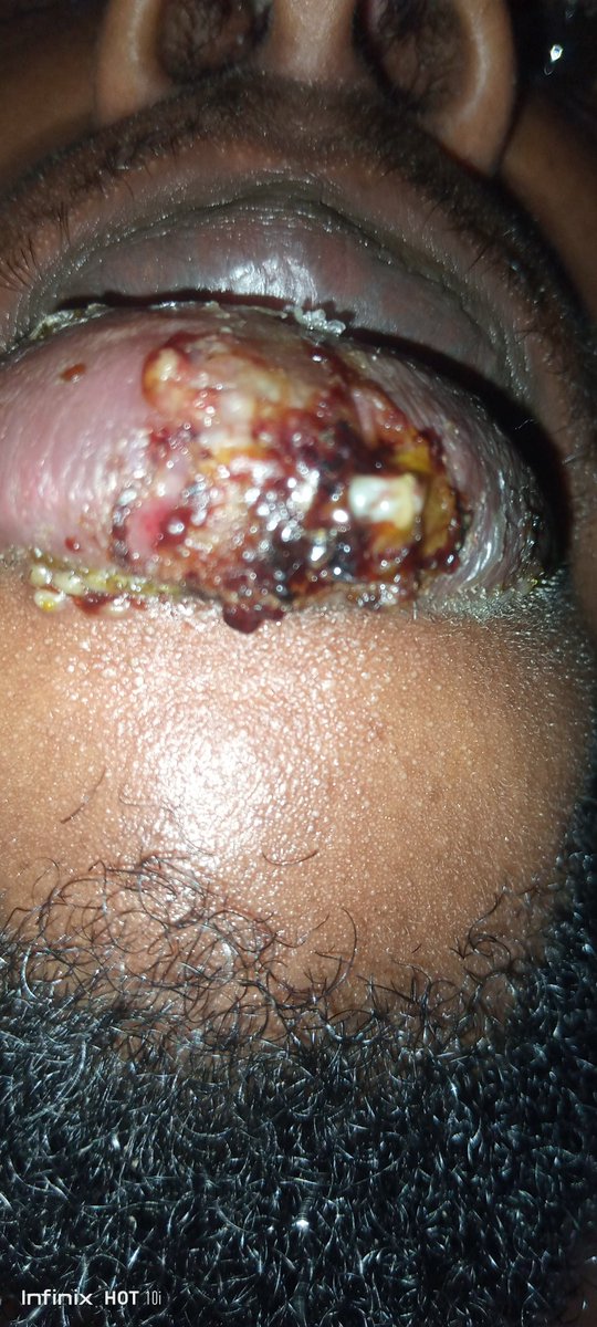 Quick recovery Mr Eyan