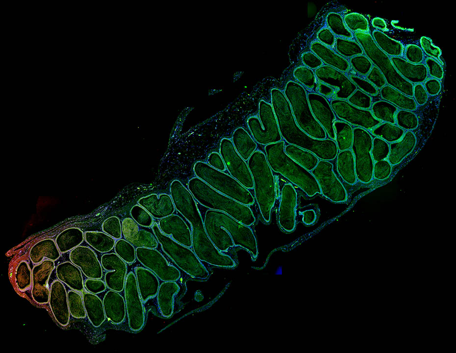 Residency programs - I want to hype @cleclinuro <a href="/MarceloMass96/">Marcelo Mass Lindenbaum, MD</a> - he is the quintessential gentleman scholar. He is giving a MAIN STAGE PLENARY at AUA this year! Twitter simply doesn't give enough room for me to sing his praises - he's simply just an amazing person. Interview him!