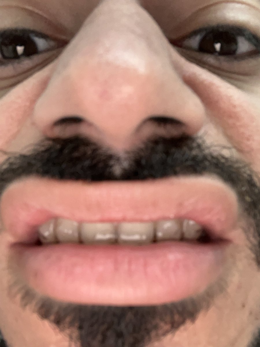 WunWunWunWun_ tweet media