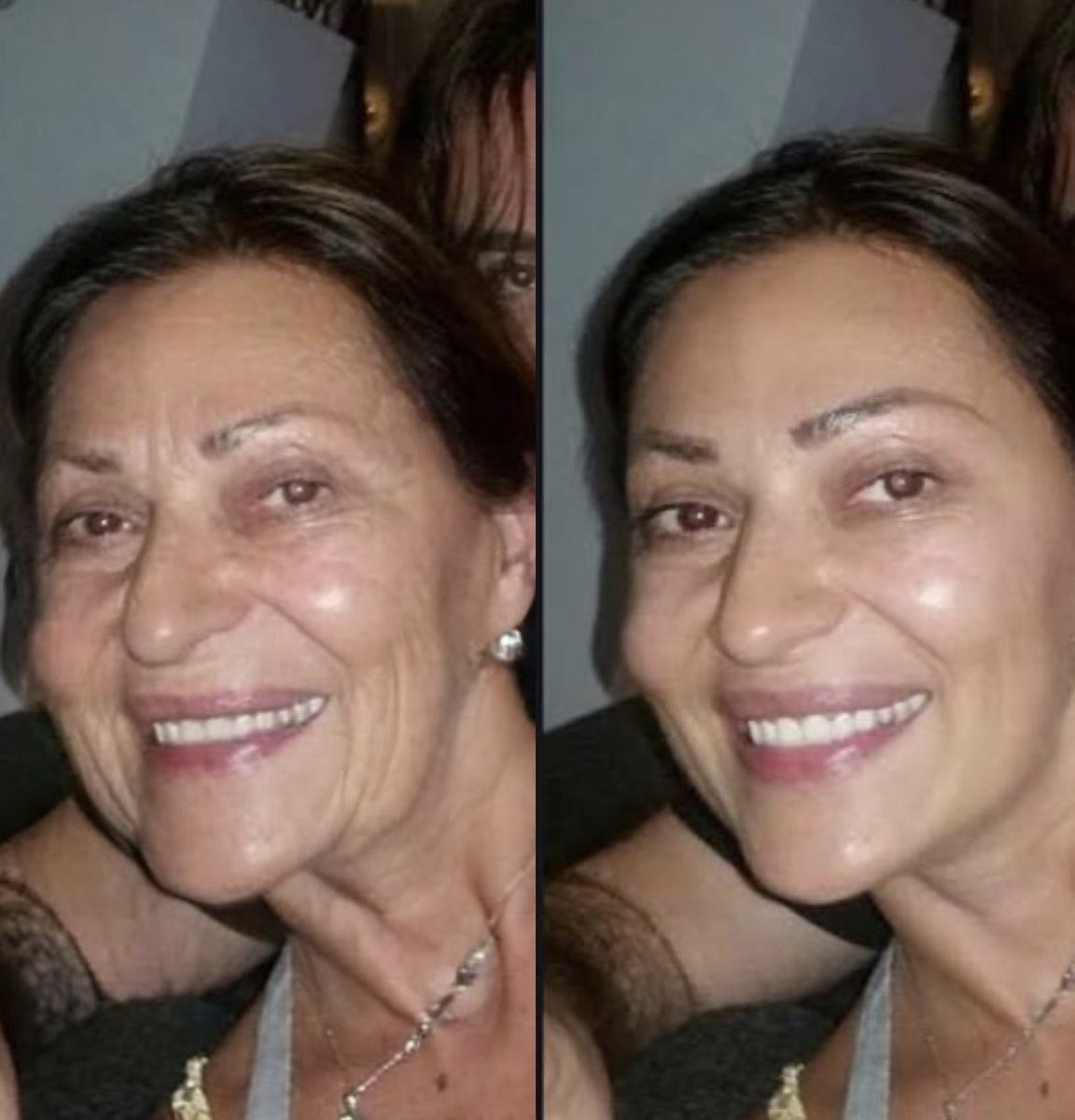 NemamKad (@nemamkadja) on Twitter photo Pojedini tviteraši ne prestaju da mesecima dele fotomontažu slike lica <a href="/karlinbich/">Jelena Karleuša</a>. Kao da je ne gledamo svake nedelje u udarnom terminu na televiziji. Nudim im primer levo kako i Ceca isto tako može biti predstavljena, doduše, ni ovo desno ne izgleda baš... lepo. 😅 Pojedini tviteraši ne prestaju da mesecima dele fotomontažu slike lica <a href="/karlinbich/">Jelena Karleuša</a>. Kao da je ne gledamo svake nedelje u udarnom terminu na televiziji. Nudim im primer levo kako i Ceca isto tako može biti predstavljena, doduše, ni ovo desno ne izgleda baš... lepo. 😅