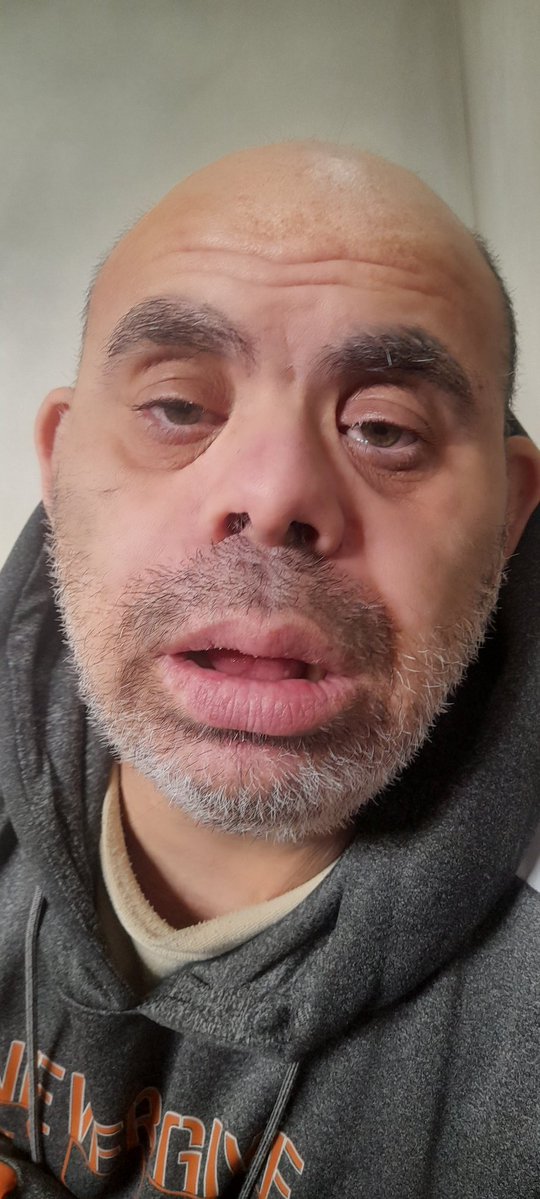 I will die😭

My body is slowly giving up I was diagnosed with malnutrition because I haven't eaten healthy food in days. I feel like I'm fading away and dying. Please help me before it's too late

If you’re scrolling, PLEASE leave a dot . it's just a dot.gofundme.com/f/DONATE-HELP-…