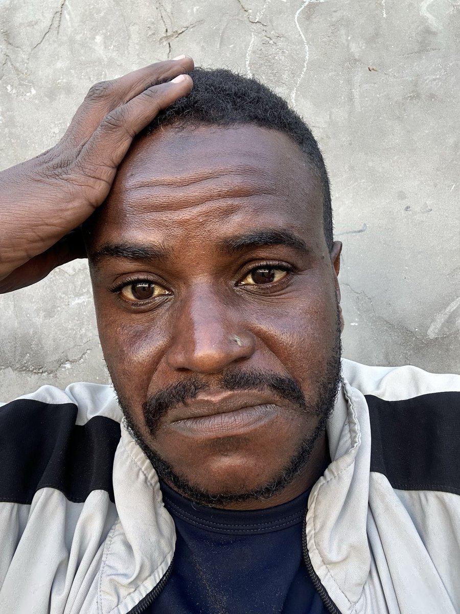 MuslehMay43064's tweet image. nfortunately, I will die 💔

telling you with a broken heart. I have been diagnosed with malnutrition due to lack of food. My body is gradually collapsing. Yes, I am hungry and I cannot buy food

If you’re scrolling, PLEASE leave a dot . it's just a dot. 

gofund.me/8d0866535