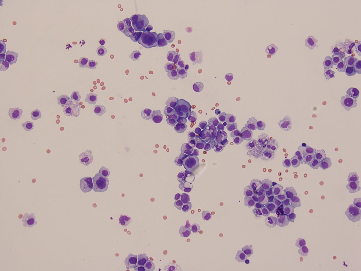 University of Iowa Pathology tweet media