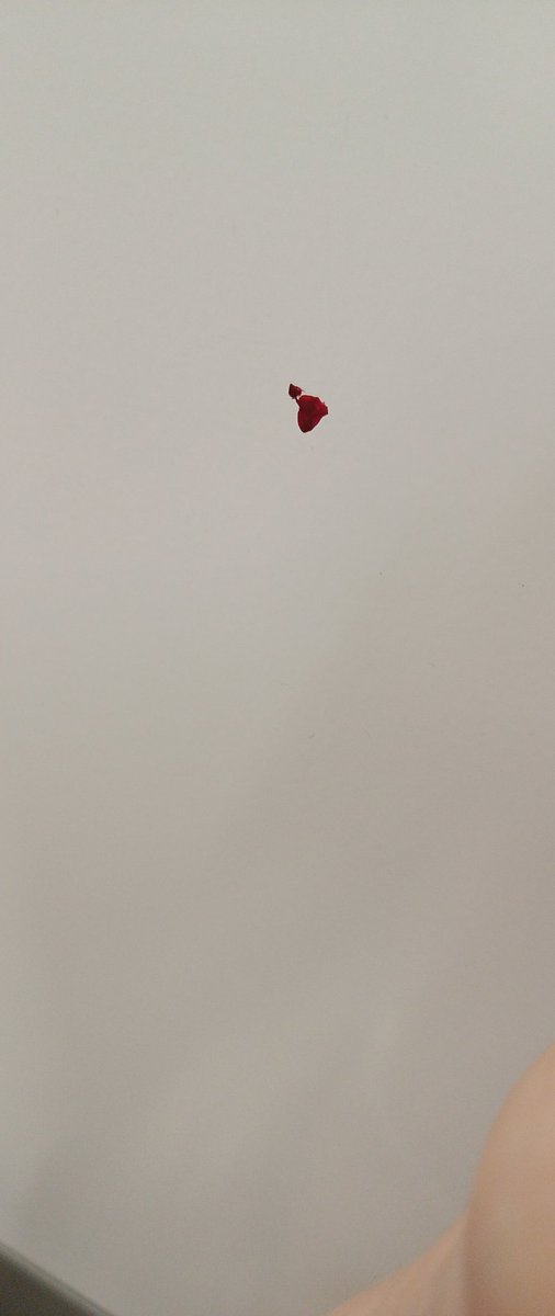 Ljp81_uk's tweet photo. @greateranglia nice little bit of blood splatter on carriage wall of 452120 , 1720 to Braintree. On first set of two seats in north end of carriage https://t.co/6WmOYv5Gkm