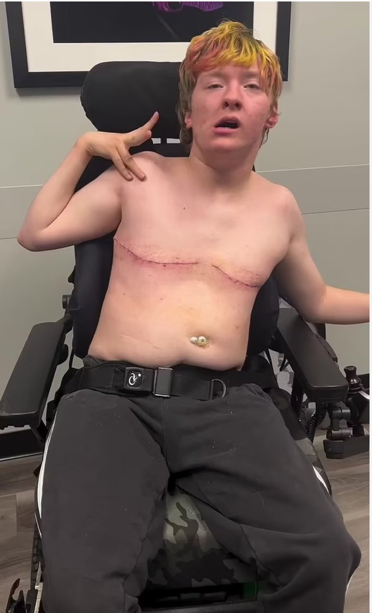 AndrewZywiecMD's tweet image. This is what transgender surgery looks like on a disabled individual. The predators will find the most vulnerable and feast on their very flesh. 

Most have no idea the level of evil that we are dealing with.

They demanded I comply. I refused. I am a doctor, not a butcher.