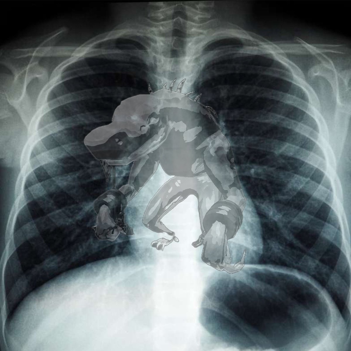 RiskofRain's tweet image. Just got my X-rays back… doc said I got that dawg in me.

Also it's poisonous and I'm not going to make it.