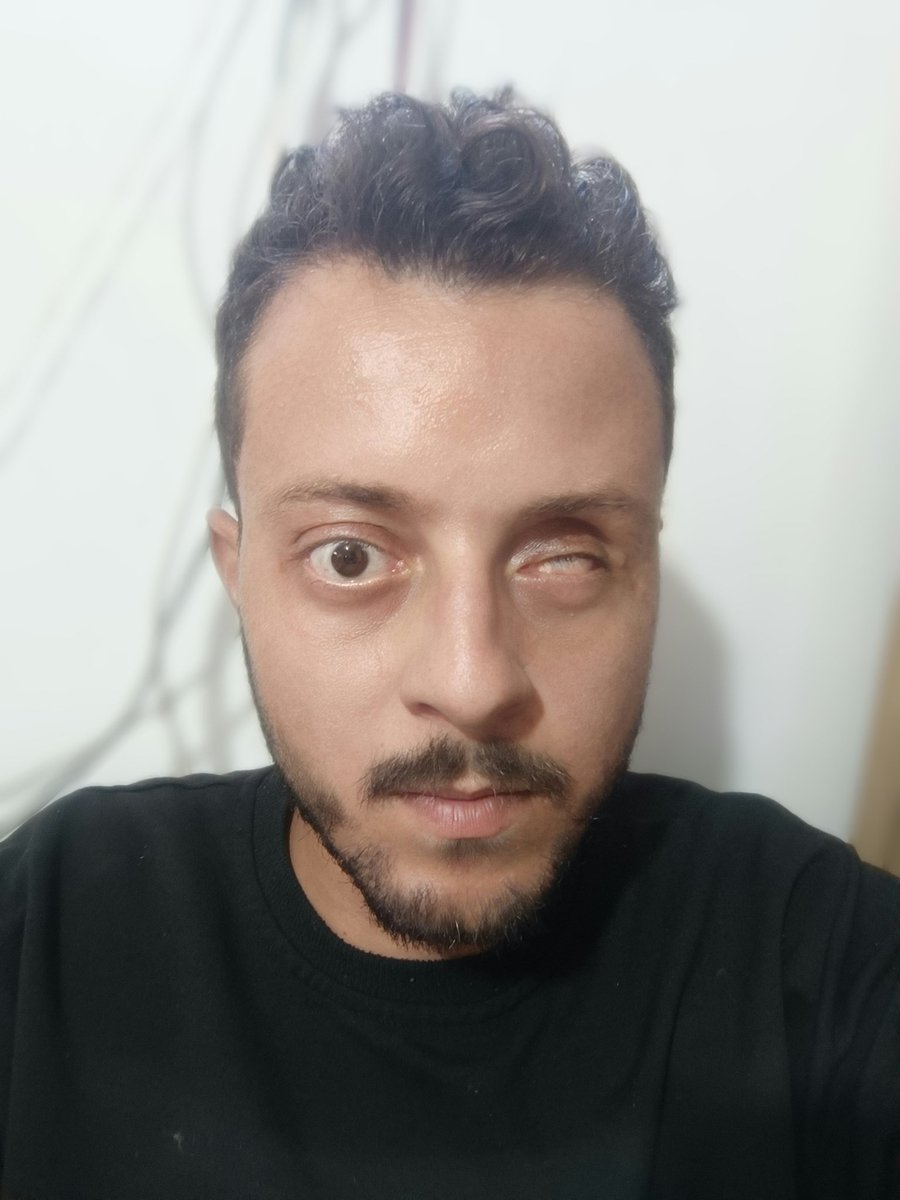 Please, DON'T LEAVE ME ALONE. We need your Support.

If you care, Please DONATE and RETWEET. Please reply with a dot. It's just a dot.
Paypal.me/ahmedshamia