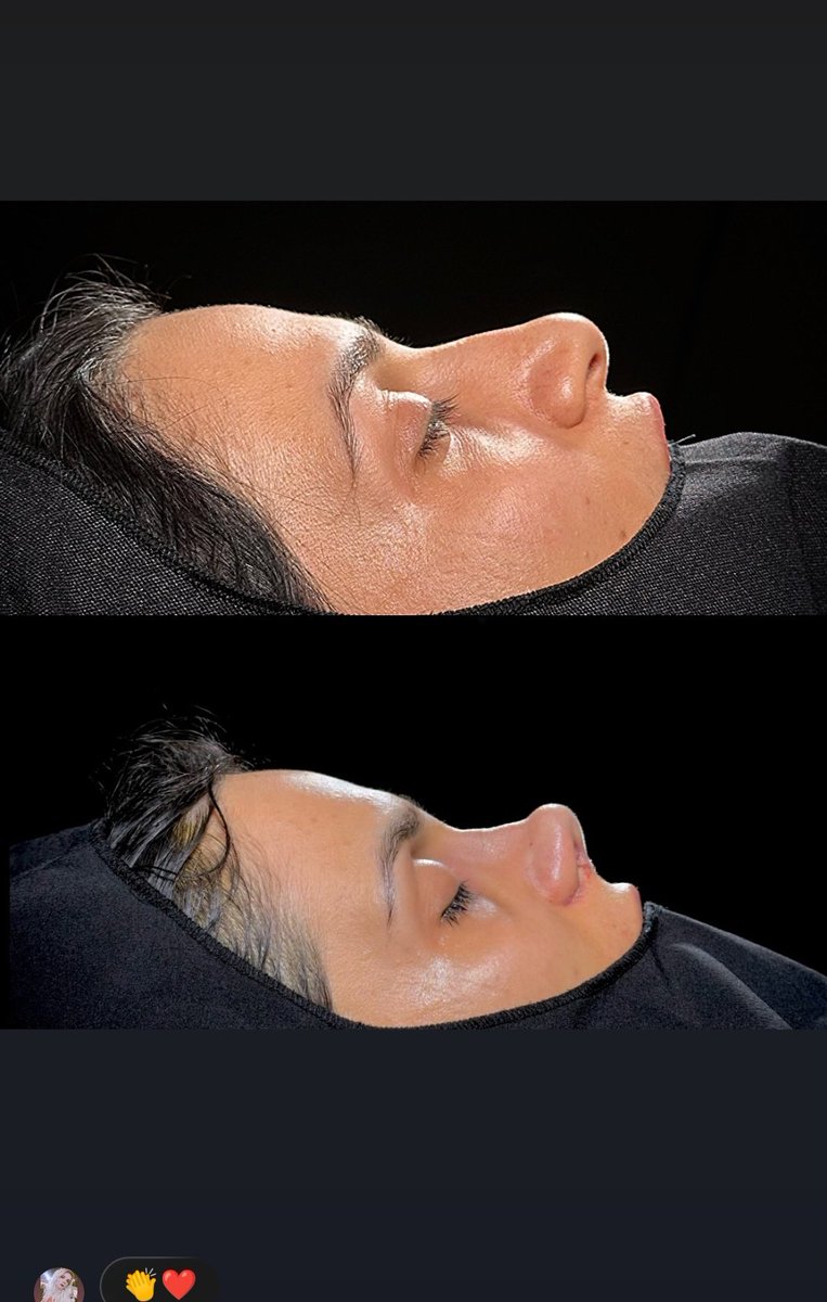 Doktor faciası eski halı daha guzelmiş bana mı öyle geldi bilmiyorum