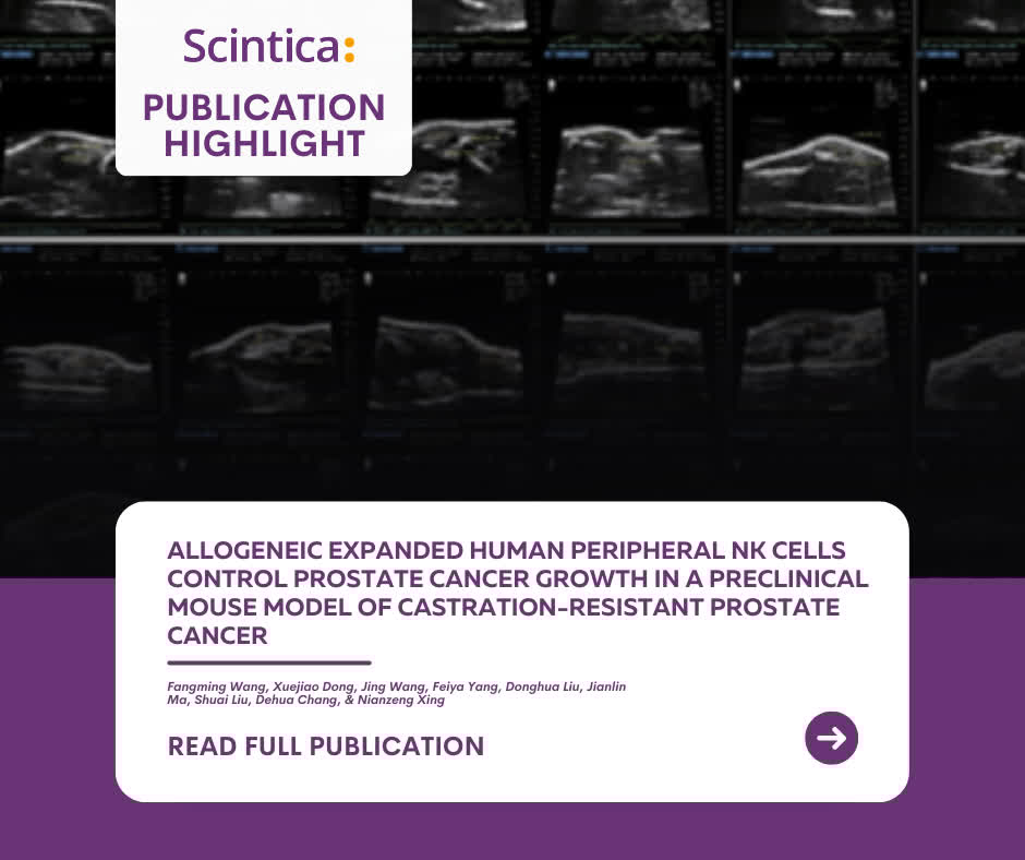 Scintica (@scinticainst) on Twitter photo Researchers used high-freq ultrasound to track NK cell therapy effects in prostate cancer,  measuring tumor size & blood flow noninvasively.
The Prospect T2 builds on this with:
✅ High-res imaging
✅ Real-time Doppler
✅ Quantitative tumor tracking
🔗 bit.ly/43fNNh3 Researchers used high-freq ultrasound to track NK cell therapy effects in prostate cancer,  measuring tumor size & blood flow noninvasively.
The Prospect T2 builds on this with:
✅ High-res imaging
✅ Real-time Doppler
✅ Quantitative tumor tracking
🔗 bit.ly/43fNNh3