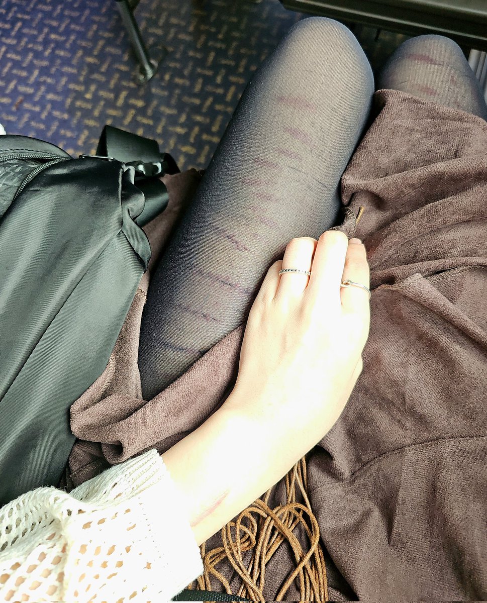 가리려고 일부러 검스 산건데 ... (o´Д`)=з
#selfharm #자해