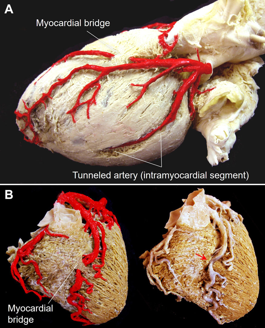 jacabreracardio's tweet image. From Structure to Clinical Insight: The Da Vinci Corner's New Series on Fundamental Anatomy | JACC: Case Reports jacc.org/doi/10.1016/j.…