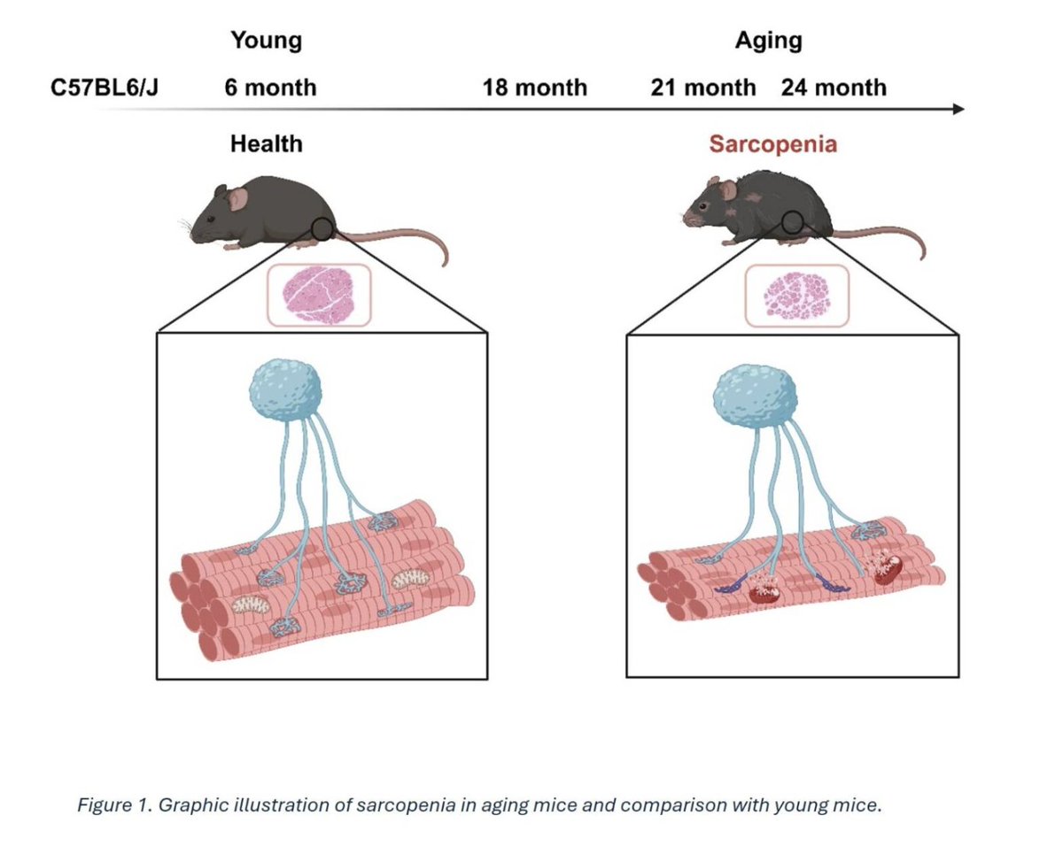 orthoscienctips's tweet photo. π§ How does aging rewire our muscles?
This @ORSsociety Basic Science Tip reveals that motor neuron decline at the NMJ may precede muscle loss in aging mice β offering clues to early sarcopenia detection.
π https://t.co/zhuC0Y6n3V
#Sarcopenia #Aging #BasicScienceTip #ORSSociety https://t.co/g74phD0ooB