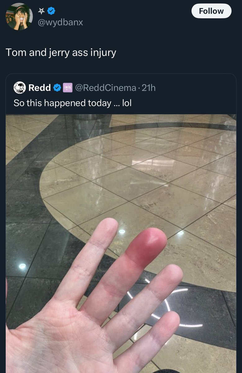 CosmonautMarcus's tweet image. Whenever I see the same post that I saw go viral a month ago I just block both parties at this point. These Twitter engagement groups need to be eradicated