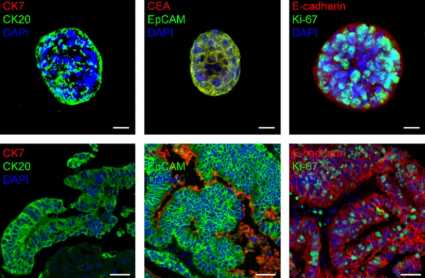Intestinal_Cell's tweet image. 💡 Researchers established a robust and stable 3DP-gastric cancer model and performed histopathological and genomic validation to find that the model well preserved the expression abundance and mutation profiles of markers in the parental tumors.
👉 bit.ly/3W9A9Ix