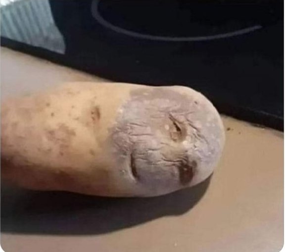 समझ नहीं आ रहा इस आलू को पकायें या हॉस्पिटल ले कर जाएं..!!😒