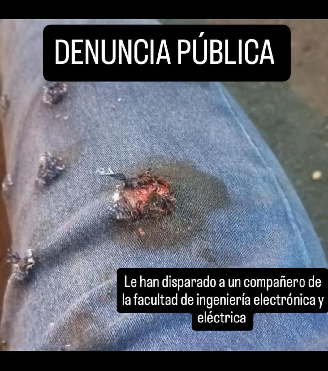 EgresadosUnmsm's tweet photo. 🚨🚨#URGENTE
Denunciamos que la PNP ha disparado a los cuerpos de los manifestantes. Difundir?
#QueSeVayanTodos https://t.co/SW64y225lj