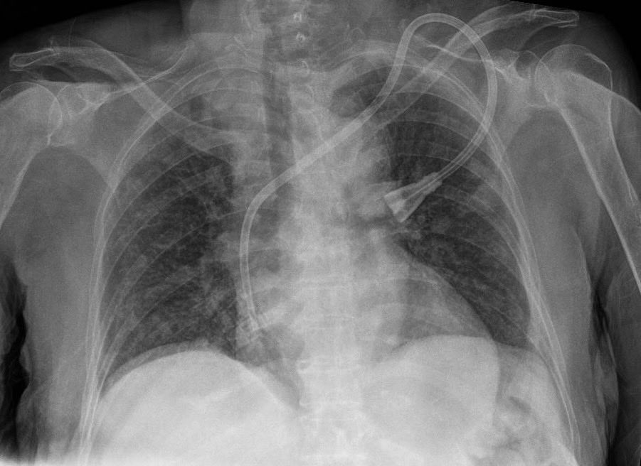 Juan Carlos Flores 🇲🇽 M.D. FISN tweet media