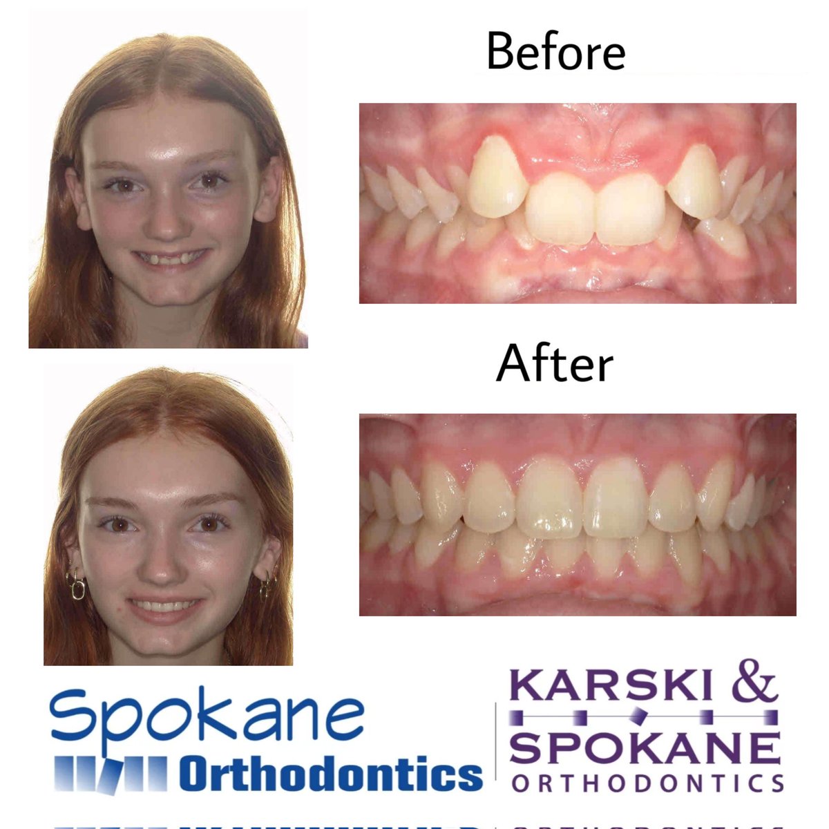 Spokane Orthodontics (@Spokane_Ortho) / Posts / X