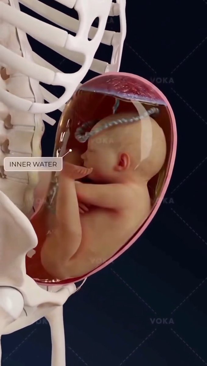 🤰 Breech Presentation क्या है और शुरुआती पहचान क्यों ज़रूरी है?

Breech Presentation तब होती है जब बच्चा गर्भाशय में अपने buttocks (नितंब) या legs (पैर) को नीचे की ओर करके स्थित होता है, सामान्य head-down (cephalic) स्थिति के बजाय।
सबसे सामान्य प्रकारों में से एक Frank Breech