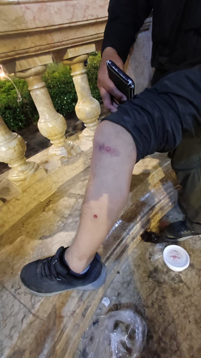 ANP_periodistas's tweet photo. #ALERTA

Fotoperiodista Antonio Melgarejo de @elcomercio_peru fue impactado por cuatro perdigones en el cuerpo mientras cubría incidencias de manifestaciones en la Plaza San Martín

Según informa, agentes policiales disparaban apuntando al cuerpo https://t.co/85b5UIXYPT