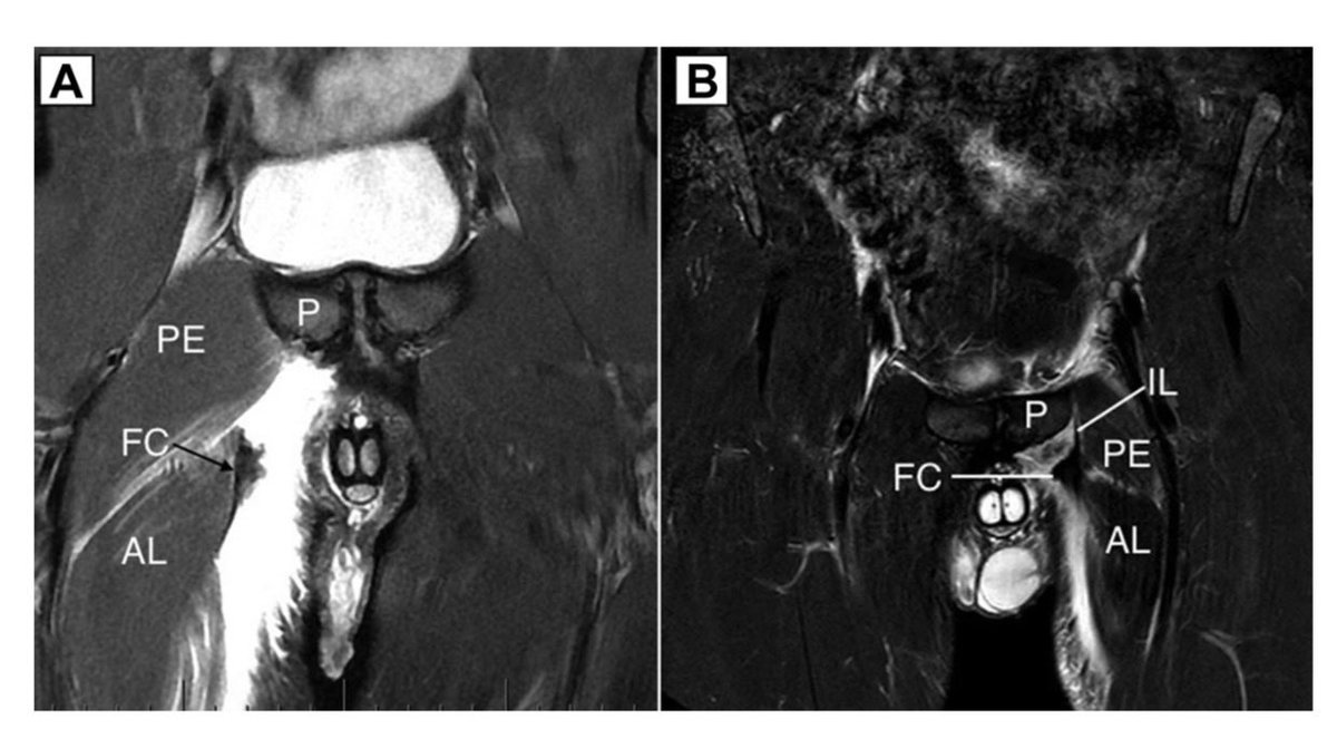 Jaime Isern Kebschull tweet media