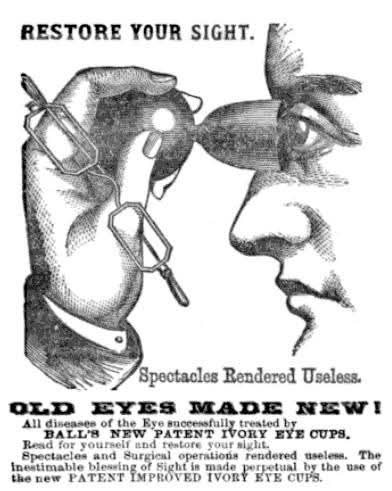 Dr. Ballin norsunluunväriset silmäkupit patentoitiin vuonna 1872, ja ne koostuivat norsunluunvärisestä kupista, joka oli kiinnitetty kumiseen ilmapalloon. Kuppi asetettiin silmämunalle ja puristettiin kumiosaa, jolloin imu loi tyhjiön ja oletettavasti(?) muutti silmämunan muotoa