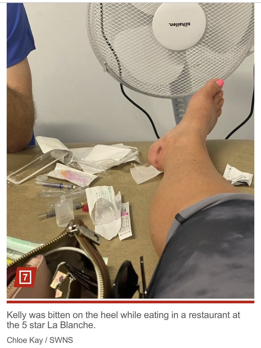 Türkiye’de 5 yıldızlı otelde yemek yerken, #başıboş bir kedi tarafından topuğundan ısırılan  İngiliz turist kadına #kuduz teşhisi kondu! 😳

Başıboş hayvan besiciliği turizm başta olmak üzere ekonomiye yönelik  bir biyoterör faaliyetidir. 

nypost.com/2025/10/15/lif…