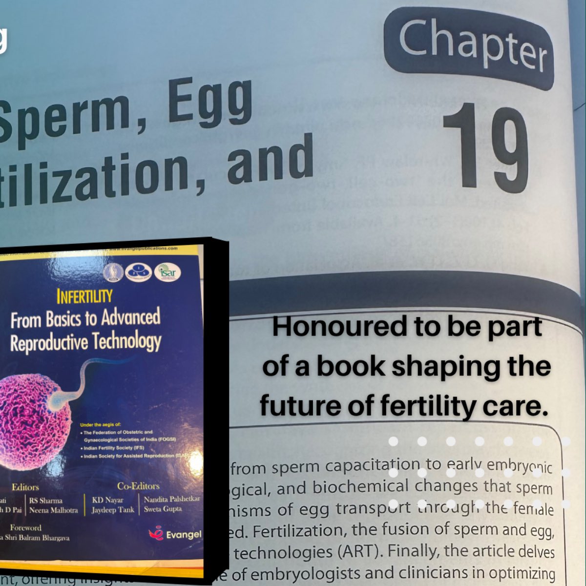 SunilKJindal1's tweet image. onoured to share my 19th textbook chapter — “Sperm Capacitation &amp;amp; Egg Transport” 📘✨
Science meets compassion to create life. ❤️
Every page written brings us closer to helping 100,000+ couples achieve parenthood. 👶🌱
#DrSunilJindal #Fertility #NART #ScienceWithHeart
