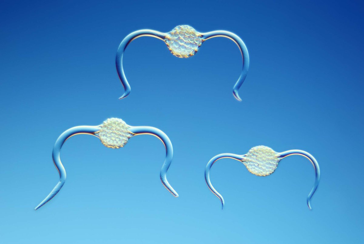jmarieali's tweet image. 🔬#Radiolarians #fossils #shells
