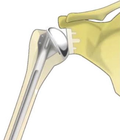 ad8111bbc's tweet image. お疲れさまです😸
鋼鉄ジーグ🤖