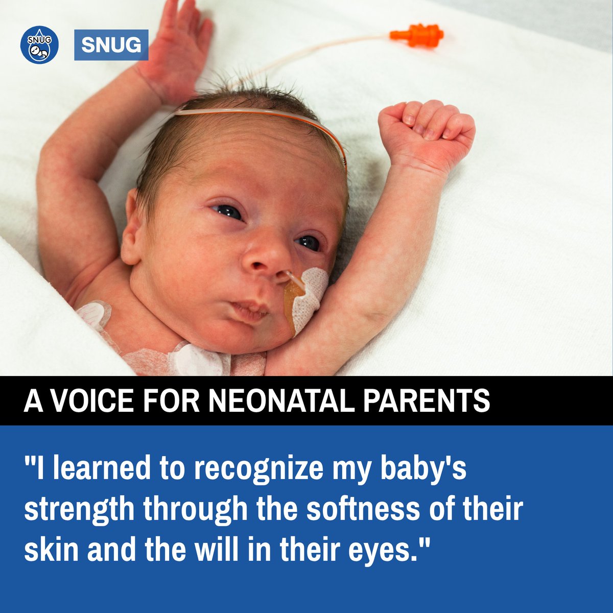 💙Let's hear what neonatal parents have to say about their journey.... 💙

📢 Let us know if this resonates with you.

 Want to have your voice heard? Comment below or pop us a message! We would LOVE to hear from you!