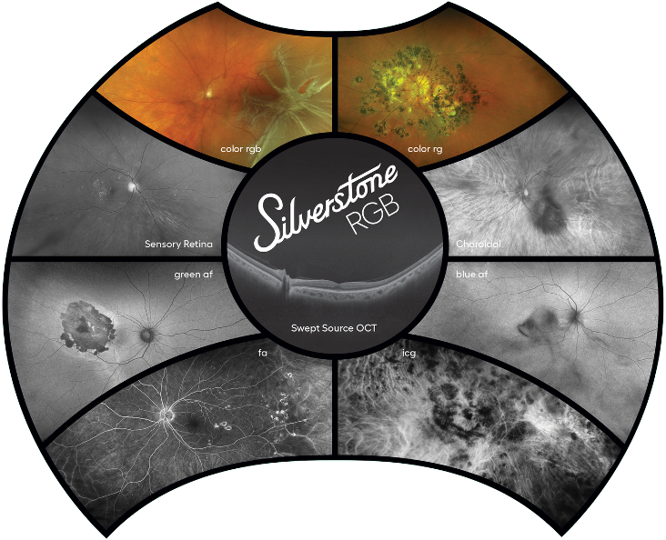 Optos announced the launch of Silverstone RGB for retinal imaging. Learn more here: ow.ly/1Z2y50Xcwmf. 
<a href="/optosuwf/">optosuwf</a> #retina #retinal #ophthalmology #eyecare