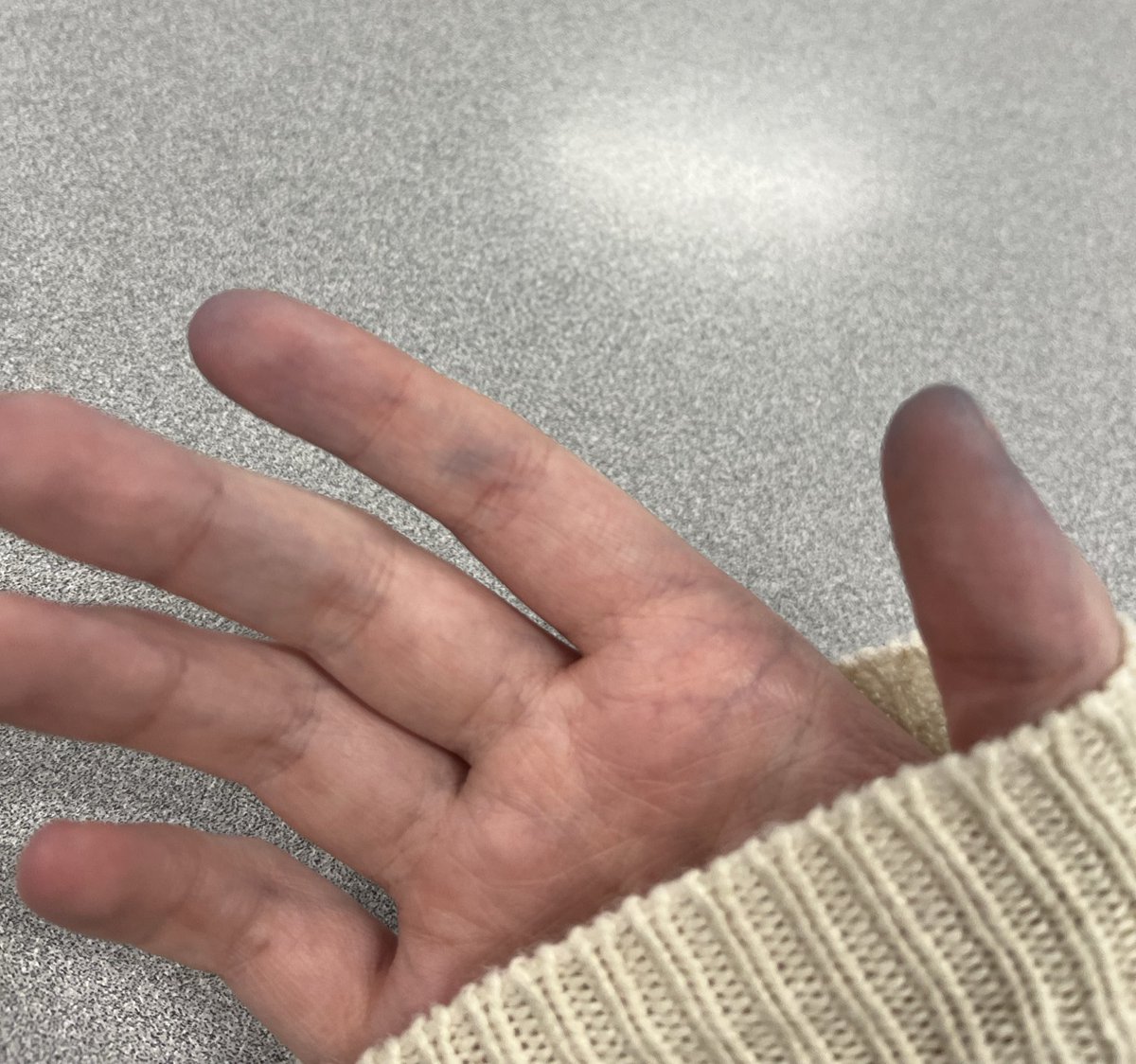 KAITOlover6000's tweet image. I just finished my spanish speaking exam and now I’m turning blue is this normal