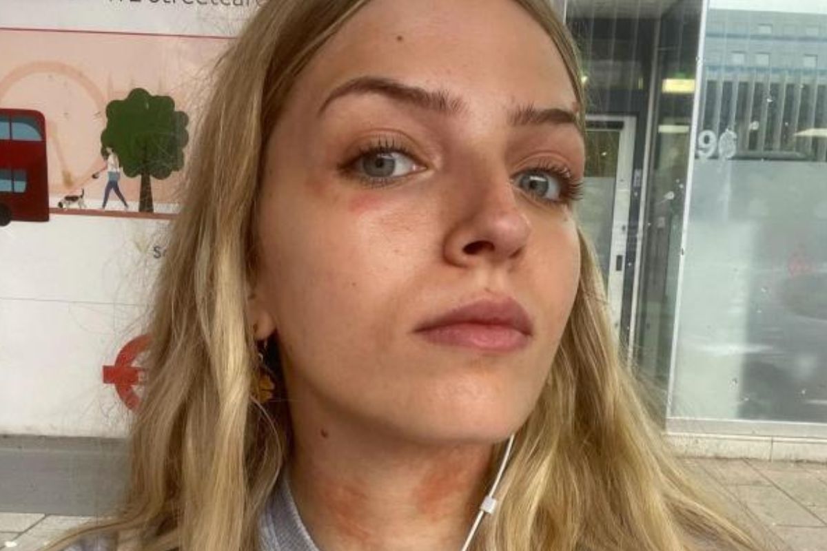 Brits warned about three deadly Victorian-era diseases that are making comeback ift.tt/8ahwkMR