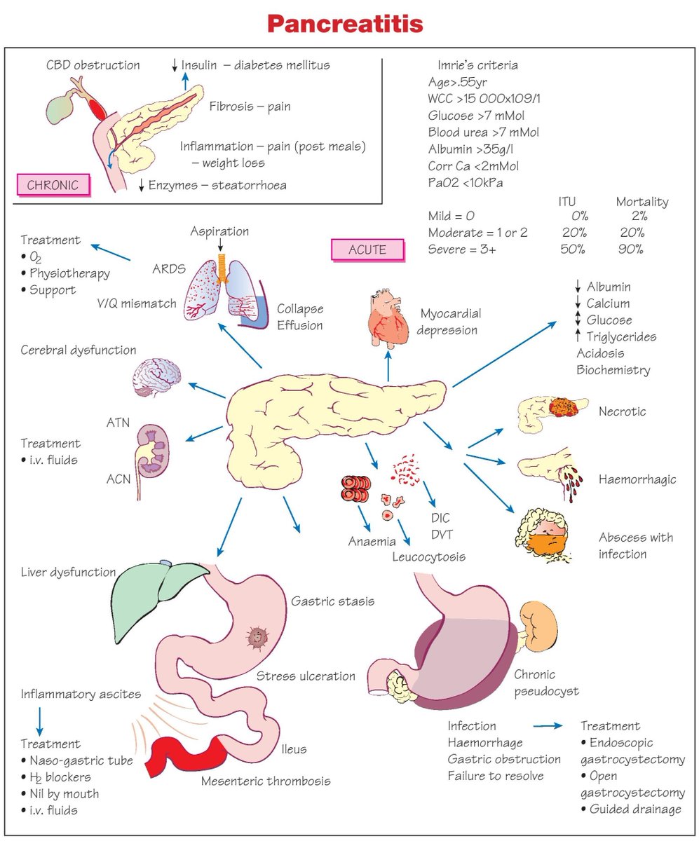 Pancreatitis Complications

#medtwitter #foamed #meded