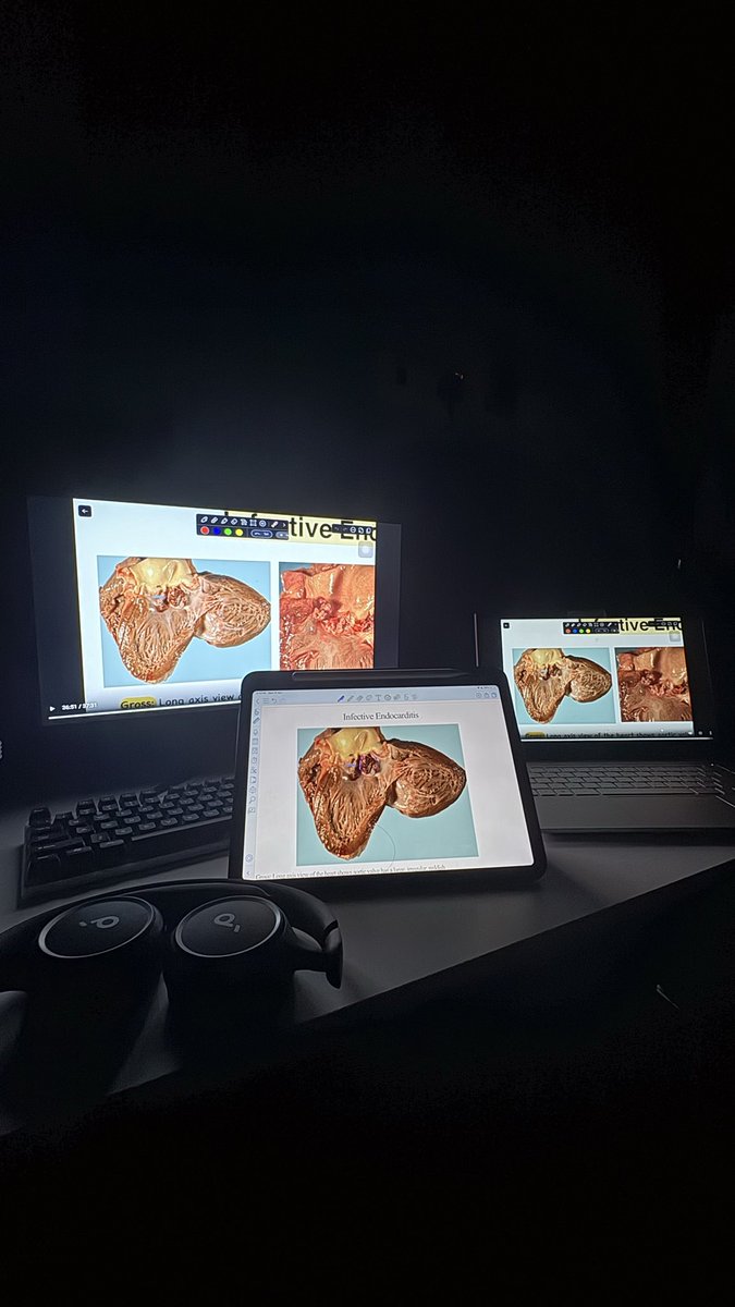 i1lww's tweet photo. Finally, CVS module is done 🫀. 

الحمدلله حتى يبلغ الحمد منتهاه 

ان شاء الله اني اديت الواجب فيه مع الكل وما قصرت مع احد وأفضل مديول بلا منازع ☝🏽. https://t.co/oK0rt2WweS