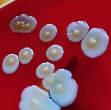 this is a colony of bacteria
yes it looks delicious
yes i want to eat it