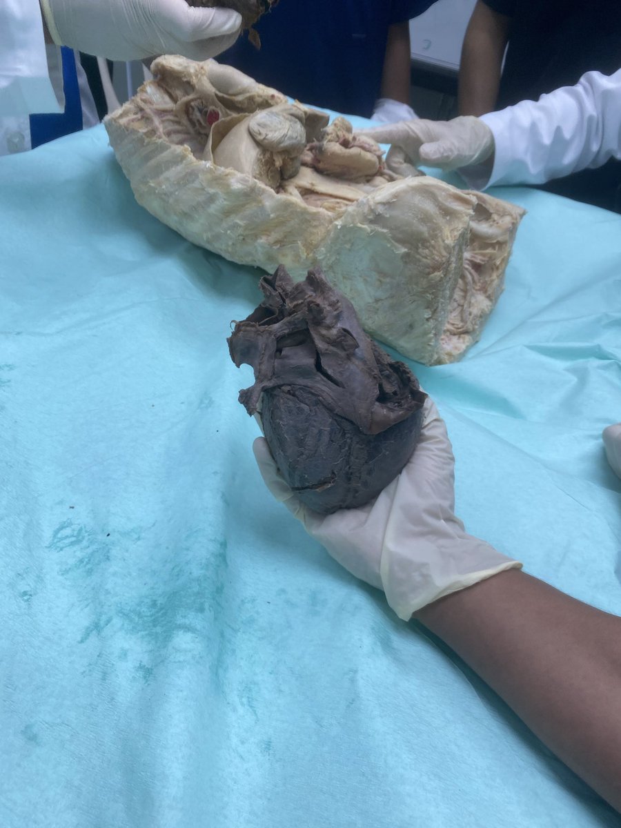 CVS✅
- ممتع كمذاكرة سيئ جدا كأختبار
