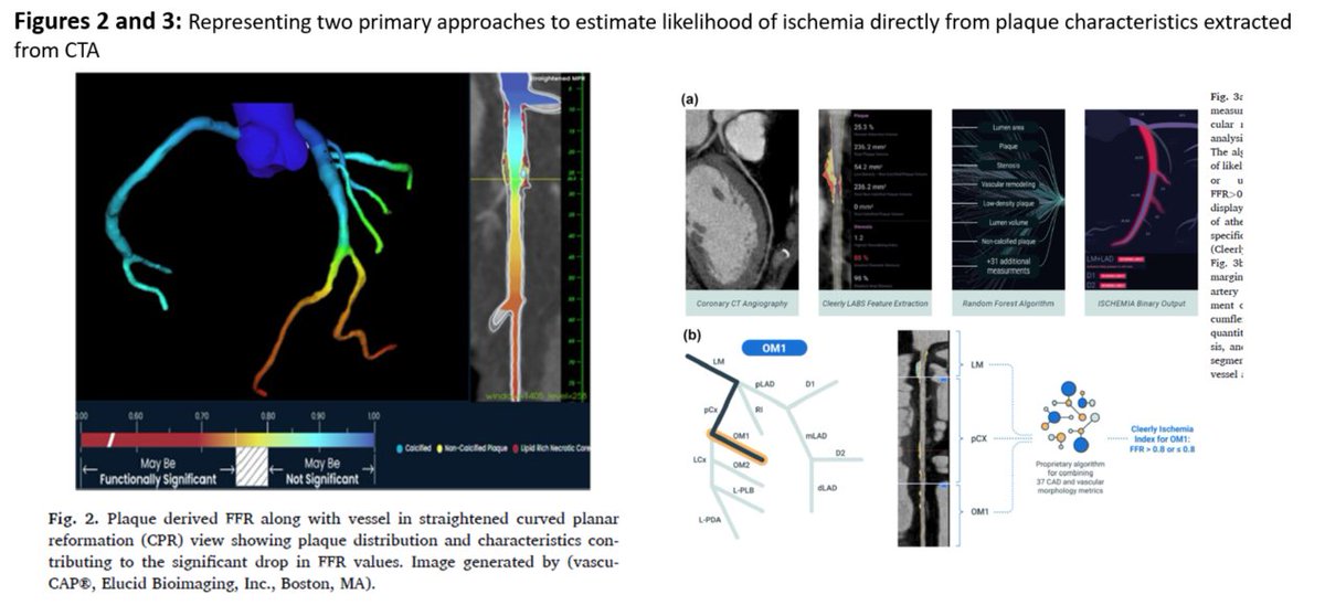 This first part of a comprehensive review by <a href="/KashifAbbasSha1/">Kashif Abbas Shaikh</a> et al discusses the methodologies for deriving fractional flow reserve (FFR) from CCTA, focusing on computational fluid dynamics (CFD) and AI techniques. 
doi.org/10.1016/j.jcct…