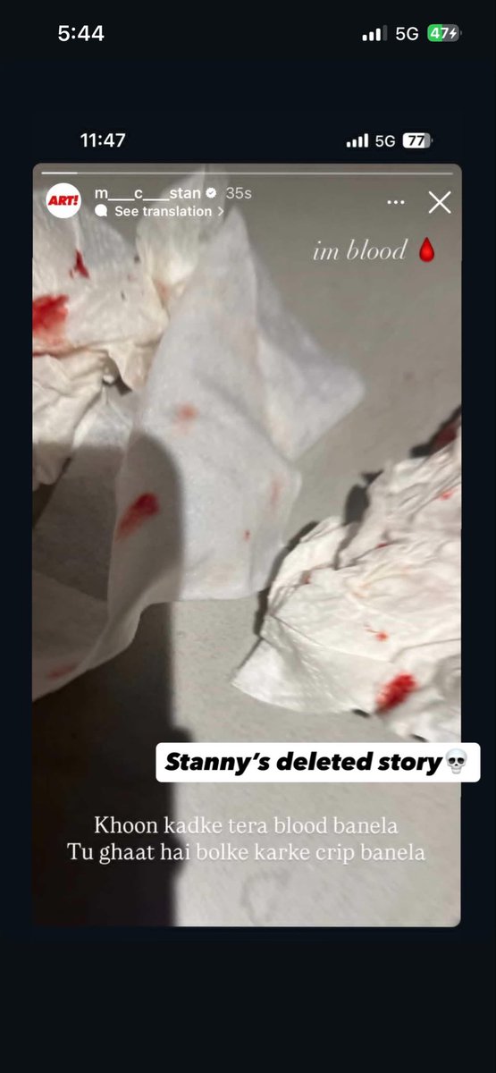 Yeh kaam kar raha din raat😭