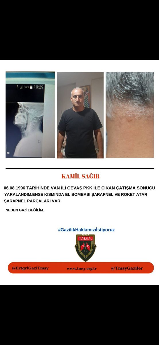 T.M.S.Y.KÂMİL SAĞIR (@tmsykmlsair1) on Twitter photo Sn. <a href="/OngorenGoksu/">Göksu ÖNGÖREN ÖZGÜR</a>,sorar mısınız "Sn. <a href="/UlviYonter/">Dr.İzzet Ulvi YÖNTER</a> Bey, <a href="/TmsyGaziler/">T.M.S.Y GAZİ SAYILMAYANLAR</a>’in hakları yıllardır beklemede. Terörle mücadelede yaralandılar, haklarını almak istiyorlar. #GazilikHakkımızıİstiyoruz
<a href="/RTErdogan/">Recep Tayyip Erdoğan</a>
<a href="/dbdevletbahceli/">Devlet Bahçeli</a>
<a href="/MahinurOzdemir/">Mahinur Özdemir Göktaş</a>
<a href="/hulusiakarmedya/">Hulusi AKAR</a>
<a href="/celebimehmeta/">Mehmet Ali Çelebi</a>
<a href="/kocakkonuralp/">Konur Alp Koçak</a> Sn. <a href="/OngorenGoksu/">Göksu ÖNGÖREN ÖZGÜR</a>,sorar mısınız "Sn. <a href="/UlviYonter/">Dr.İzzet Ulvi YÖNTER</a> Bey, <a href="/TmsyGaziler/">T.M.S.Y GAZİ SAYILMAYANLAR</a>’in hakları yıllardır beklemede. Terörle mücadelede yaralandılar, haklarını almak istiyorlar. #GazilikHakkımızıİstiyoruz
<a href="/RTErdogan/">Recep Tayyip Erdoğan</a>
<a href="/dbdevletbahceli/">Devlet Bahçeli</a>
<a href="/MahinurOzdemir/">Mahinur Özdemir Göktaş</a>
<a href="/hulusiakarmedya/">Hulusi AKAR</a>
<a href="/celebimehmeta/">Mehmet Ali Çelebi</a>
<a href="/kocakkonuralp/">Konur Alp Koçak</a>