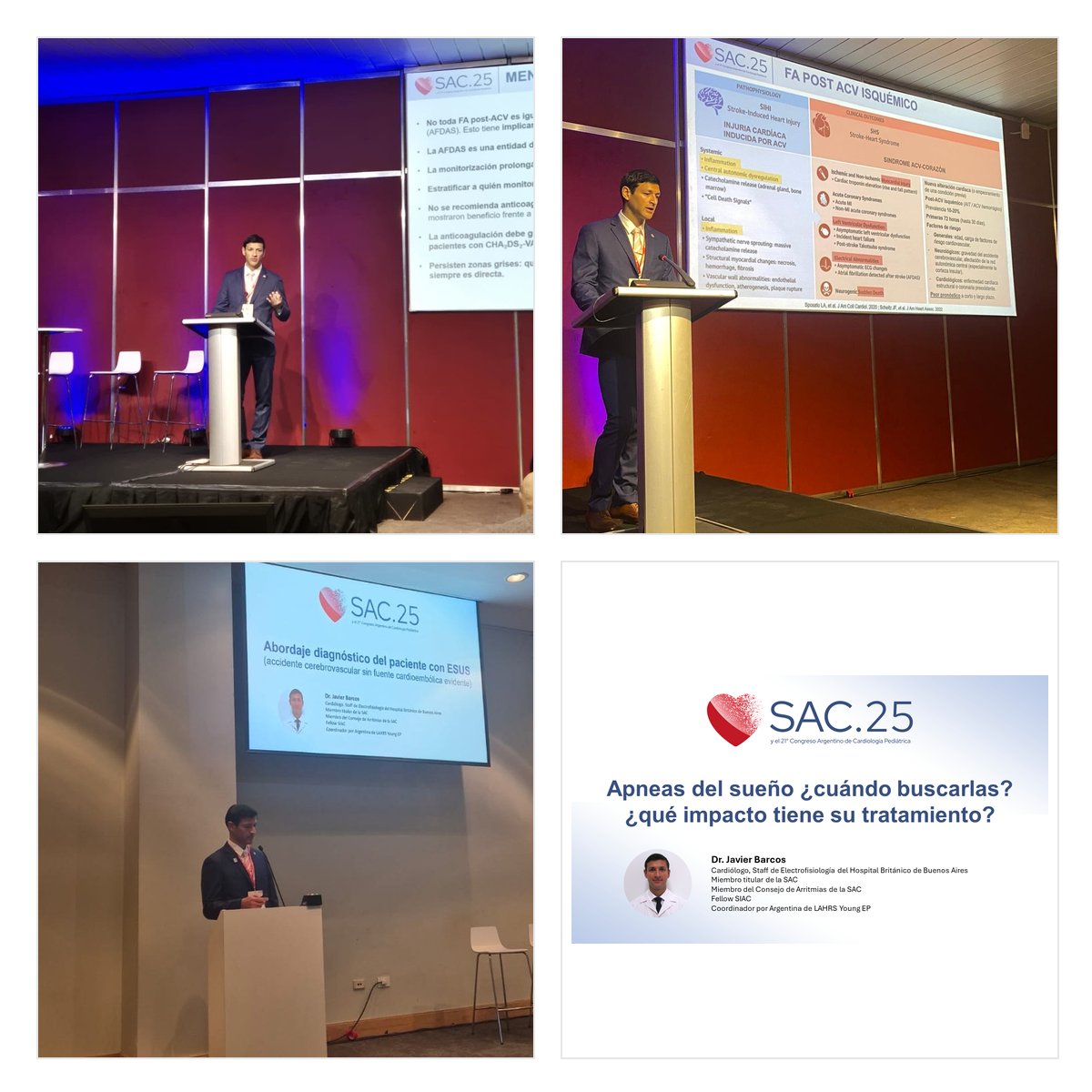 Ayer, tres disertaciones en #SAC25: FA post ACV • Apneas del sueño en FA • ESUS/FA oculta. Foco: prevención, diagnóstico precoz y enfoque integral.