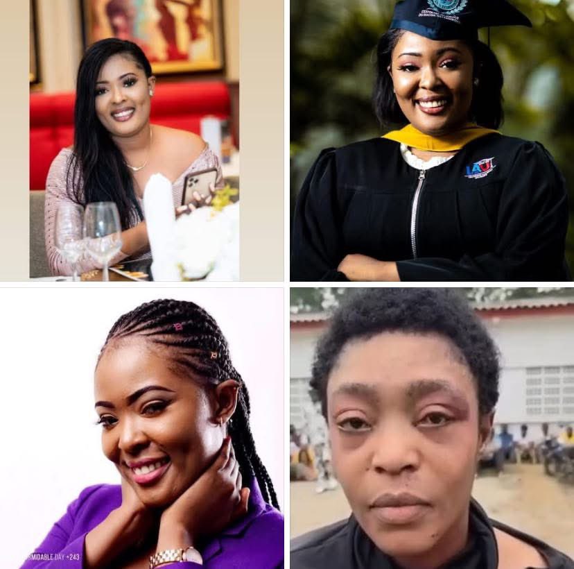 Makunda (@r_makunda) on Twitter photo #RDC : Elle c’est #Honorine Mwanda,La femme criminelle qui faisait partie de ceux qui ont fait incursion dans les installations de la Rawbank aujourd’hui.
Encore une femme battante, femme claire en même temps 🤣🤣 <a href="/judaRdc/">JudaRdc🇨🇩❤️</a> <a href="/Observateur_X/">OBSERVATEUR 🇨🇩</a> <a href="/chauffeur243/">CHAUFFEUR Tout-Kin</a> #RDC : Elle c’est #Honorine Mwanda,La femme criminelle qui faisait partie de ceux qui ont fait incursion dans les installations de la Rawbank aujourd’hui.
Encore une femme battante, femme claire en même temps 🤣🤣 <a href="/judaRdc/">JudaRdc🇨🇩❤️</a> <a href="/Observateur_X/">OBSERVATEUR 🇨🇩</a> <a href="/chauffeur243/">CHAUFFEUR Tout-Kin</a>