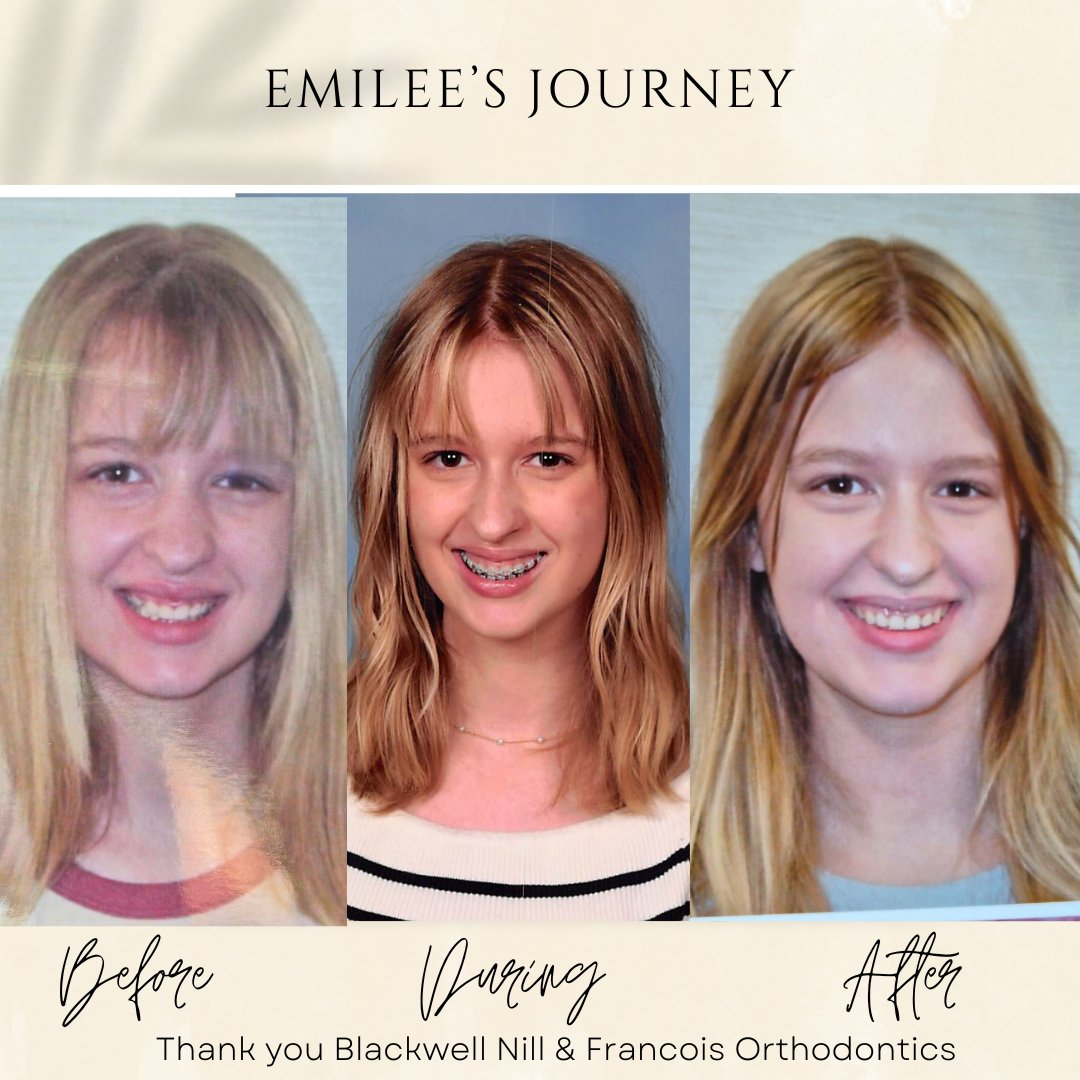 AccessRecordsS's tweet image. Shout out to Blackwell Nill &amp;amp; Francois Orthodontics for the great job they did. #smallbusinesssupportingsmallbusiness #SmallBusinessRocks #supportlocal #SupportSmallBusiness